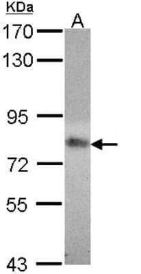 Western Blot: MTHFR Antibody [NBP1-33530]