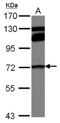 Western Blot: MTHFR Antibody [NBP2-19430]