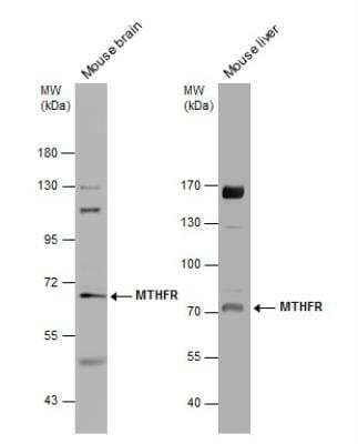 Western Blot: MTHFR Antibody [NBP2-19430]