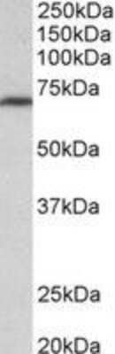 Western Blot: MTHFR Antibody [NBP2-27549]