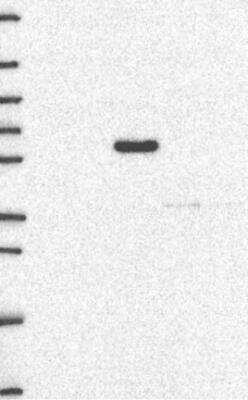 Western Blot: MTHFR Antibody [NBP3-17040]