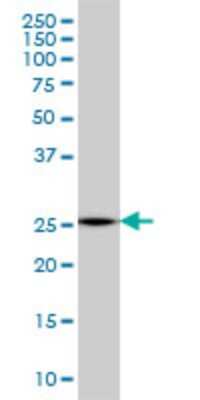 Western Blot: MTHFS Antibody (2C12) [H00010588-M01]