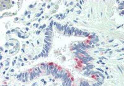 Immunohistochemistry-Paraffin: MTHFS Antibody [NBP1-20947]