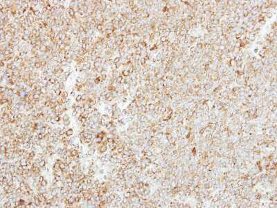 Immunohistochemistry-Paraffin: MTHFS Antibody [NBP2-19431]