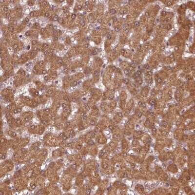 Immunohistochemistry-Paraffin: MTHFS Antibody [NBP2-58656]
