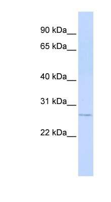 Western Blot: MTHFS Antibody [NBP1-56698]