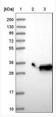 Western Blot: MTHFS Antibody [NBP1-83161]