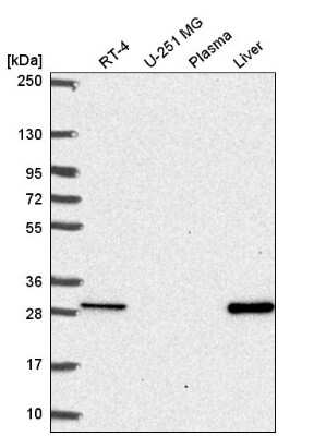 Western Blot: MTHFS Antibody [NBP2-58656]