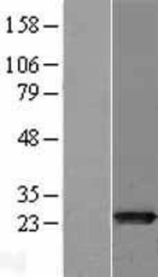 Western Blot: MTHFS Overexpression Lysate [NBL1-13366]