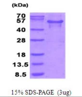 SDS-PAGE: Recombinant Human MTHFSD His Protein [NBP2-51942]