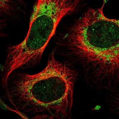 Immunocytochemistry/ Immunofluorescence: MTIF2 Antibody [NBP2-55804]