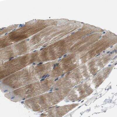 Immunohistochemistry-Paraffin: MTIF2 Antibody [NBP1-81609]