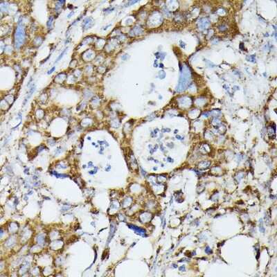 Immunohistochemistry-Paraffin: MTIF2 Antibody - Azide and BSA Free [NBP2-95177]