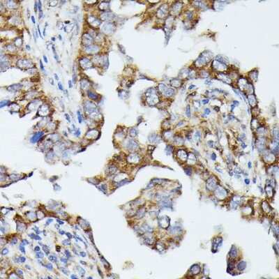 Immunohistochemistry-Paraffin: MTIF2 Antibody - Azide and BSA Free [NBP2-95177]