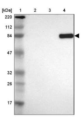 Western Blot: MTIF2 Antibody [NBP1-81609]