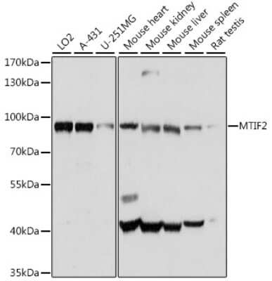 Western Blot: MTIF2 AntibodyAzide and BSA Free [NBP2-95177]