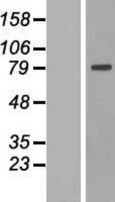 Western Blot: MTIF2 Overexpression Lysate [NBP2-08114]