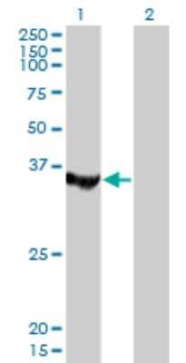 Western Blot: MTMR1 Antibody (1F10) [H00008776-M01]