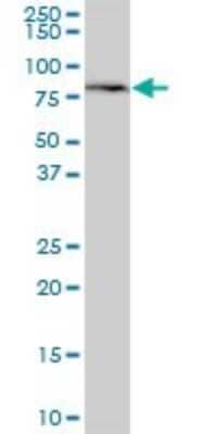 Western Blot: MTMR1 Antibody [H00008776-B01P]