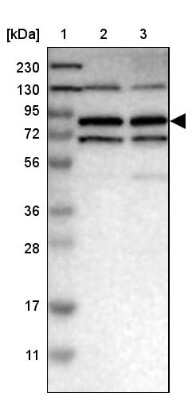 Western Blot: MTMR1 Antibody [NBP1-86042]