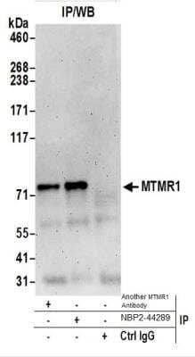 Western Blot: MTMR1 Antibody [NBP2-44289]