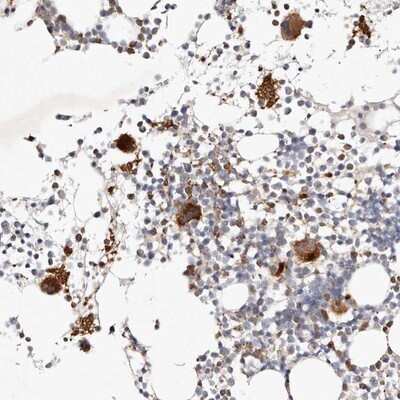 Immunohistochemistry-Paraffin: MTMR11 Antibody [NBP1-90620]