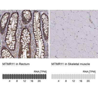 Immunohistochemistry-Paraffin: MTMR11 Antibody [NBP3-17127]