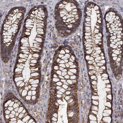 Immunohistochemistry-Paraffin: MTMR11 Antibody [NBP3-17127]