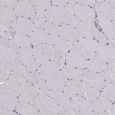 Immunohistochemistry-Paraffin: MTMR11 Antibody [NBP3-17127]