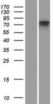 Western Blot: MTMR11 Overexpression Lysate [NBP2-09768]