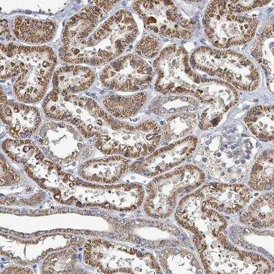 Immunohistochemistry-Paraffin: MTMR12 Antibody [NBP2-13625]