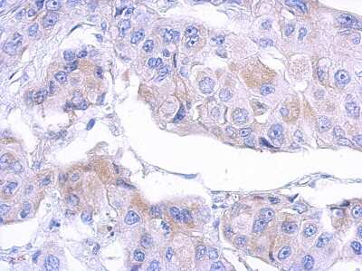 Immunohistochemistry-Paraffin: MTMR12 Antibody [NBP2-19432]