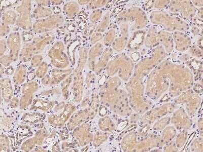 Immunohistochemistry-Paraffin: MTMR12 Antibody [NBP2-97310]