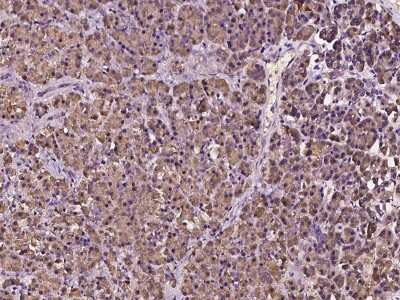 Immunohistochemistry-Paraffin: MTMR12 Antibody [NBP2-97310]