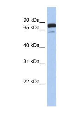 Western Blot: MTMR12 Antibody [NBP1-54988]