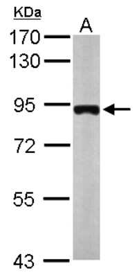 Western Blot: MTMR12 Antibody [NBP2-19432]