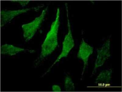 Immunocytochemistry/ Immunofluorescence: MTMR14 Antibody (3B11) [H00064419-M01]