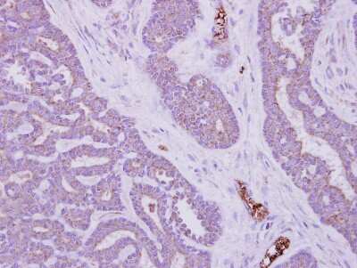 Immunohistochemistry-Paraffin: MTMR14 Antibody [NBP1-32416]