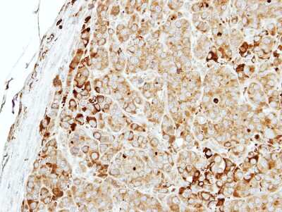 Immunohistochemistry-Paraffin: MTMR14 Antibody [NBP2-19433]