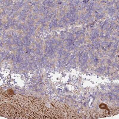 Immunohistochemistry-Paraffin: MTMR14 Antibody [NBP2-33703]