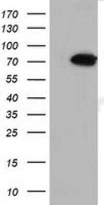 Western Blot: MTMR14 Antibody (OTI6B6)Azide and BSA Free [NBP2-72808]