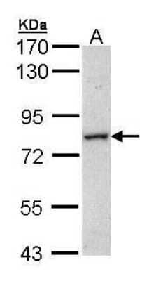 Western Blot: MTMR14 Antibody [NBP1-32416]