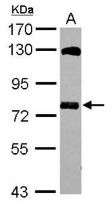 Western Blot: MTMR14 Antibody [NBP2-19433]