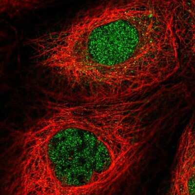 Immunocytochemistry/ Immunofluorescence: MTMR15 Antibody [NBP2-56425]