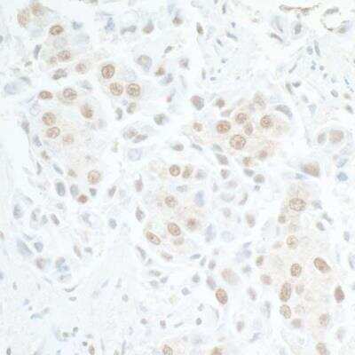 Immunohistochemistry-Paraffin: MTMR15 Antibody [NBP1-42677]