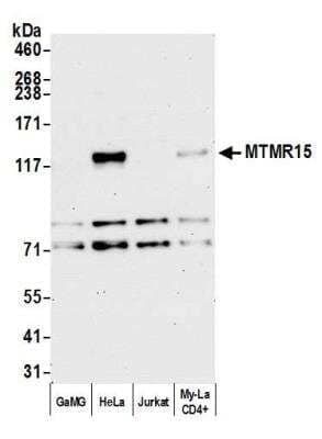 Western Blot: MTMR15 Antibody [NBP1-42677]