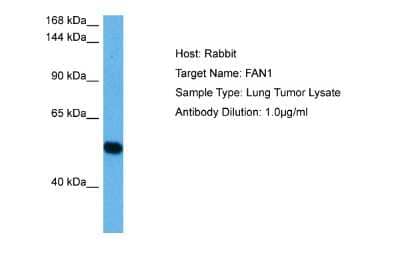 Western Blot: MTMR15 Antibody [NBP2-87856]