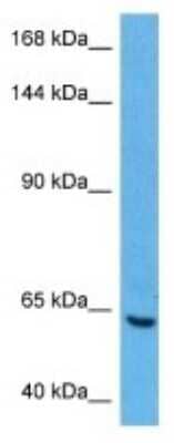 Western Blot: MTMR15 Antibody [NBP3-10992]