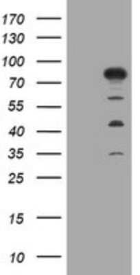 Western Blot: MTMR2 Antibody (OTI1F10) [NBP2-46035]