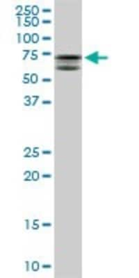 Western Blot: MTMR2 Antibody (4G6) [H00008898-M03]